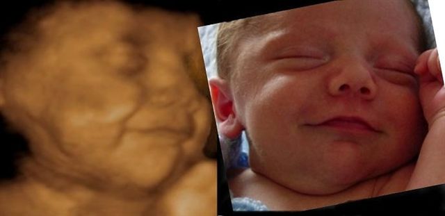 3 d ultrasound baby pics